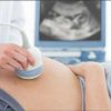 Mẹ bầu ăn uống đủ chất sẽ giúp thai nhi phát triển tốt