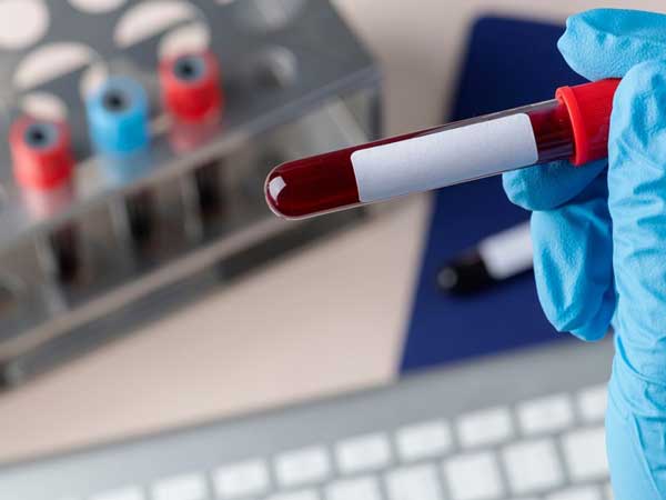 Double Test là một xét nghiệm sàng lọc trong tam cá nguyệt đầu tiên