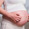 Sự thay đổi của hormone estrogen và progesterone có thể khiến mẹ bầu bị ngứa